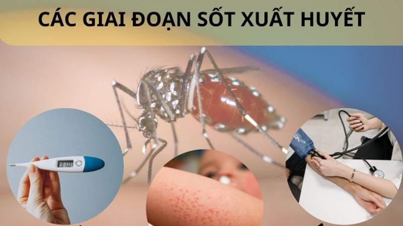 các giai đoạn sốt xuất huyết